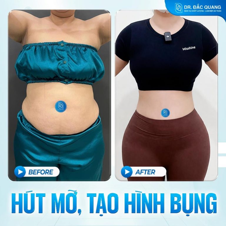Bụng Bảo Xuyến