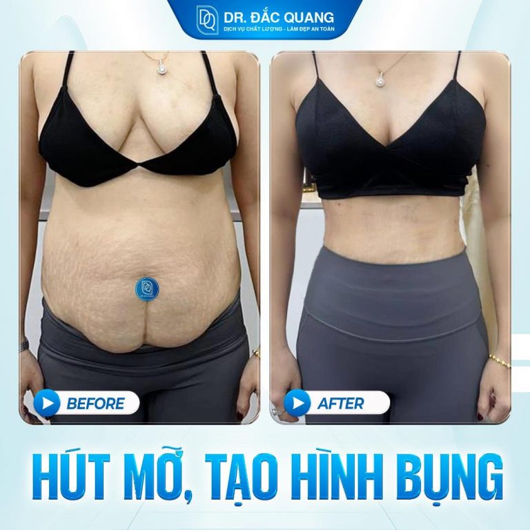 Bụng Ng Thị Minh Kiều