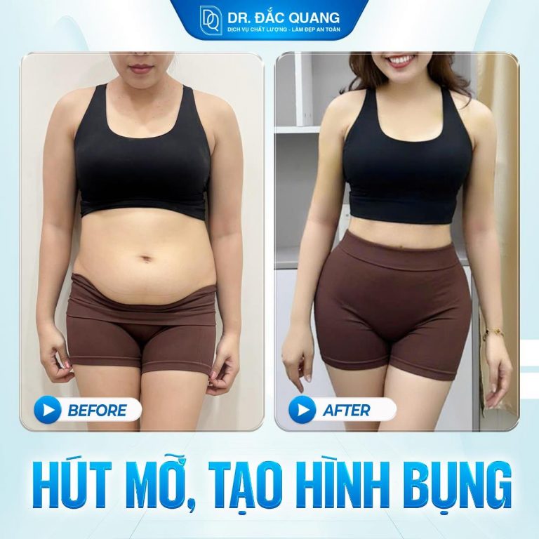 Bụng Trần Đăng Hà