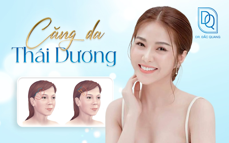 căng da thái dương