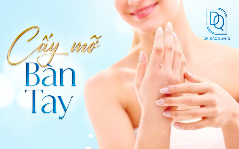 cấy mỡ bàn tay