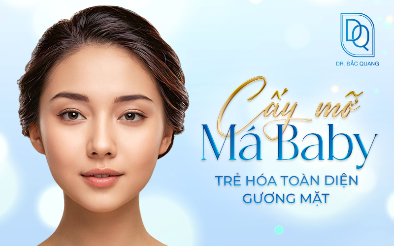 cấy mỡ má baby