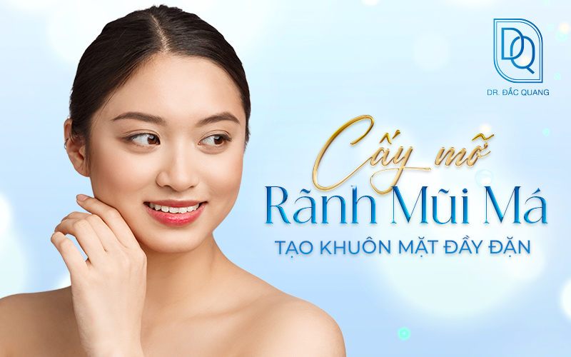 cấy mỡ rãnh mũi má