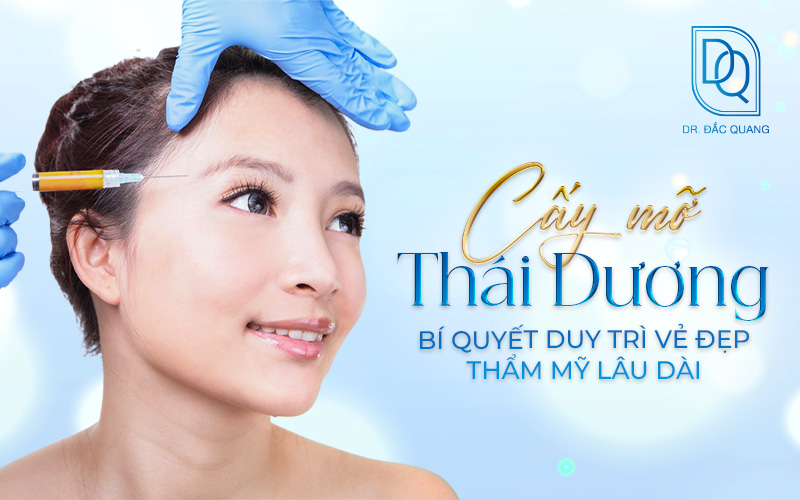 cấy mỡ thái dương