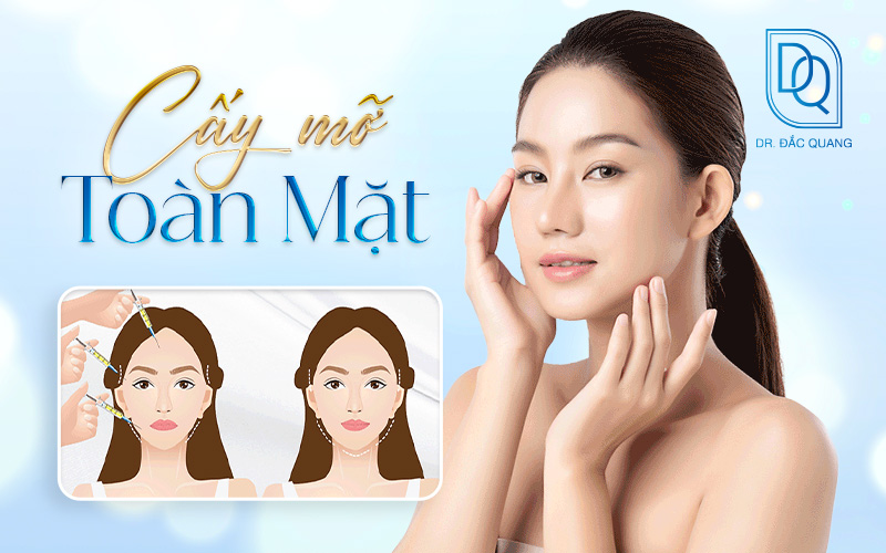cấy mỡ toàn mặt