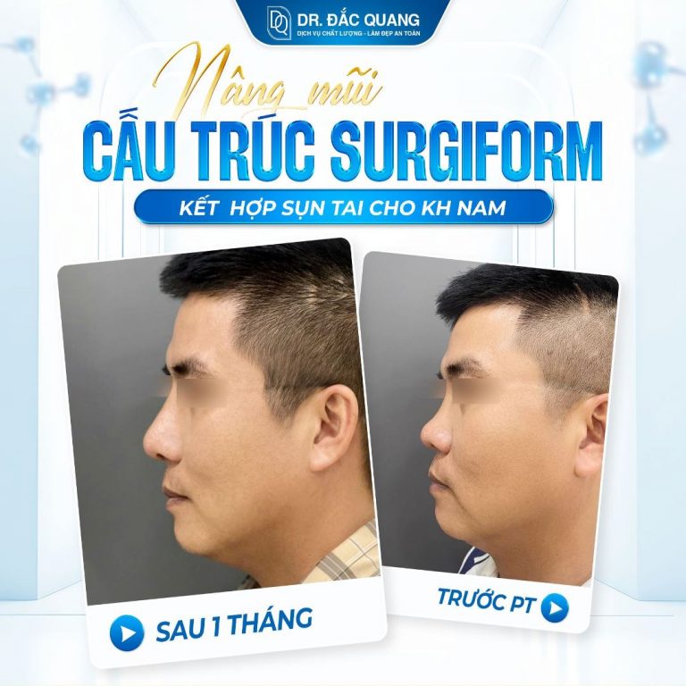Hoàng Diên Tuấn (mũi cấu trúc)