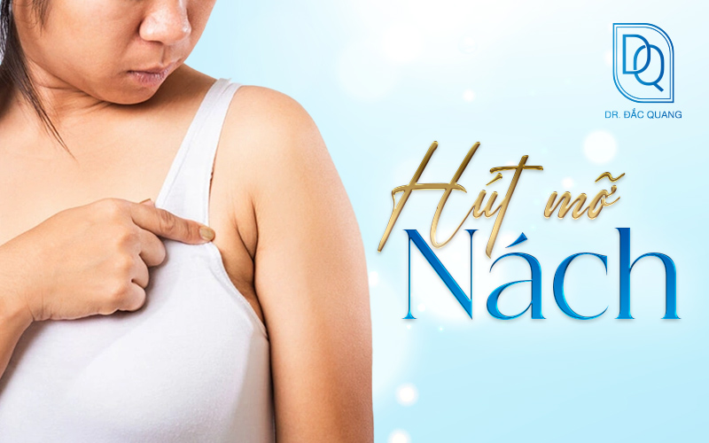 hút mỡ nách