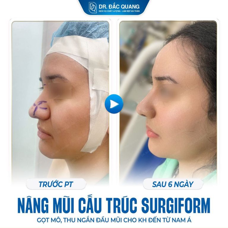 Maryan Nguyễn (mũi)