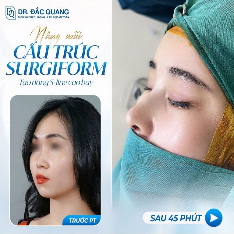 Mũi 1