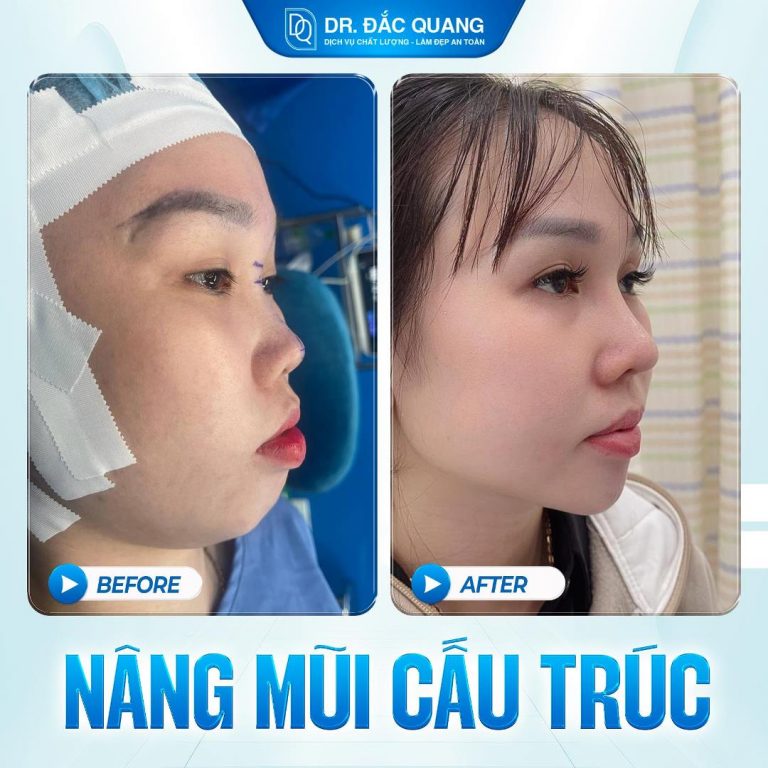 Mũi Nguyễn Thị Thảo