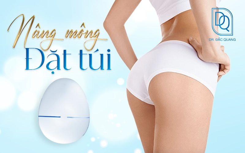 nâng mông đặt túi