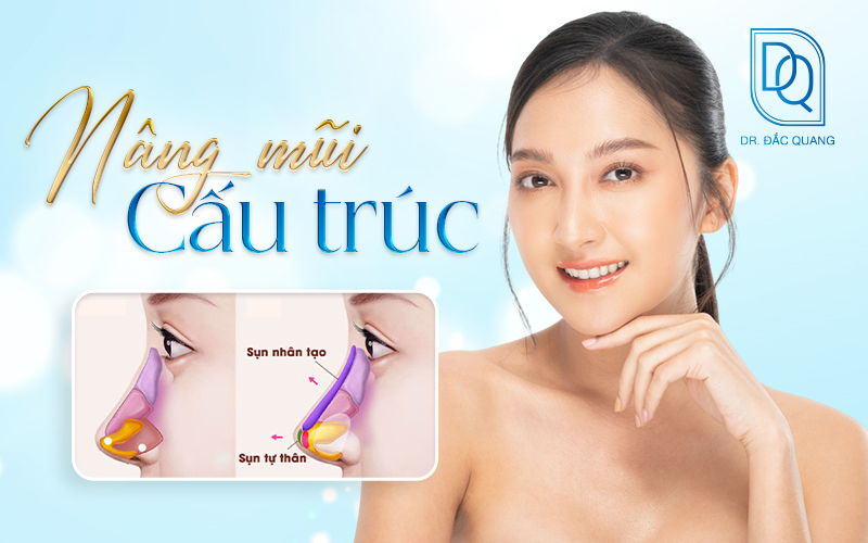 nâng mũi cấu trúc