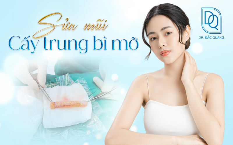 sửa mũi cây trùng bì mỡ
