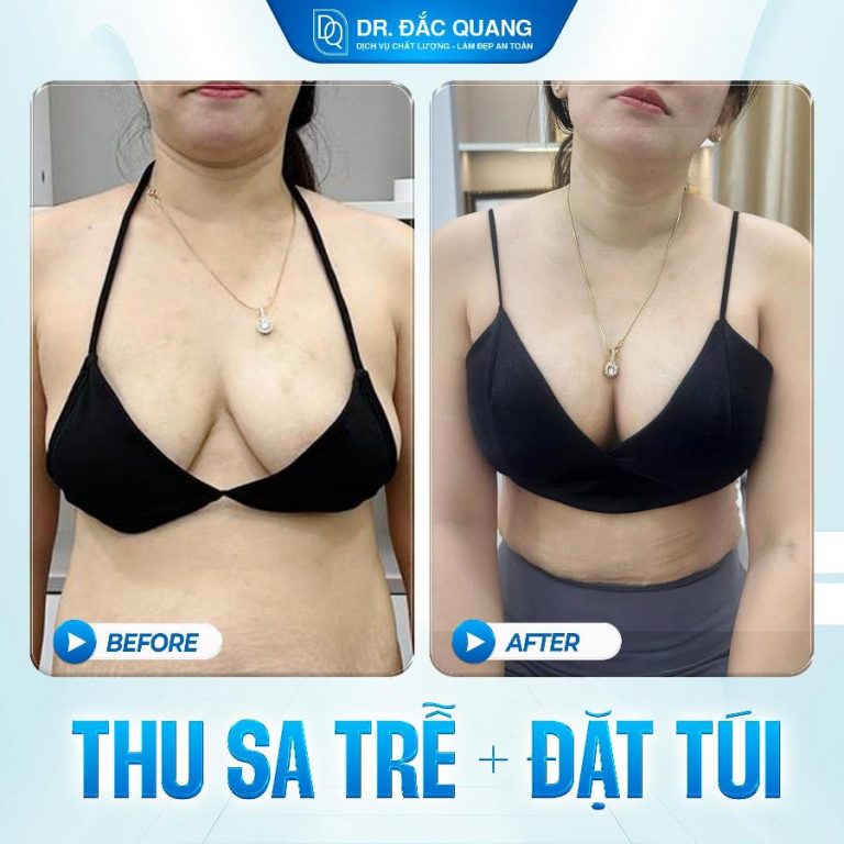 Thu sa trễ Ng Thị Minh Kiều
