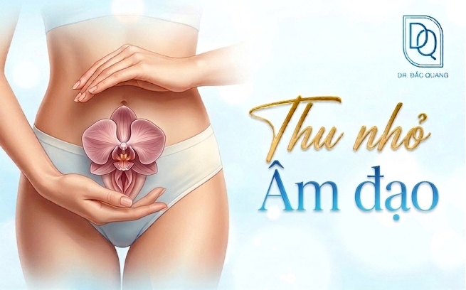 thu nhỏ âm đạo