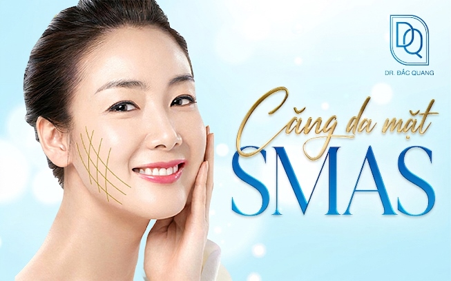 căng da mặt SMAS