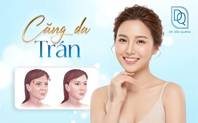 căng da trán
