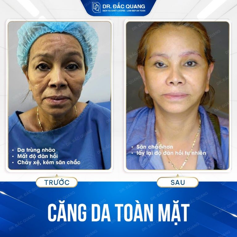 cangda10