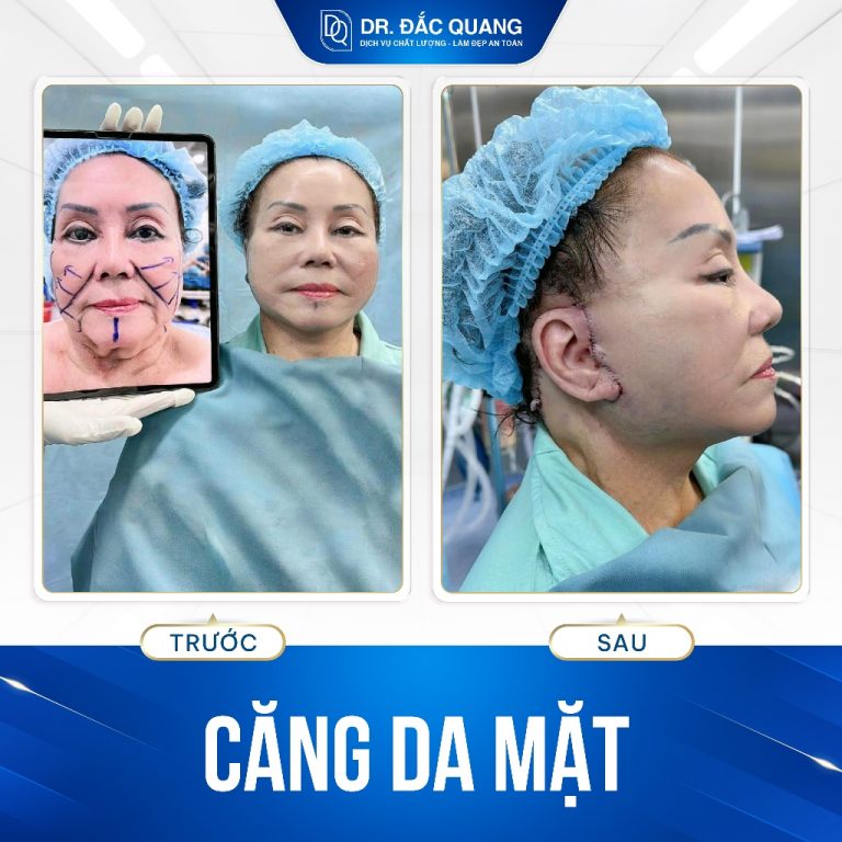 cangda16