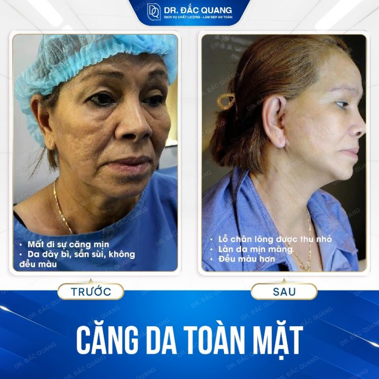 cangda9