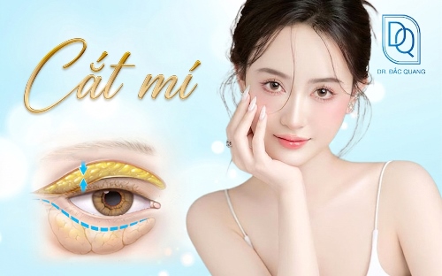 Dịch vụ cắt mí