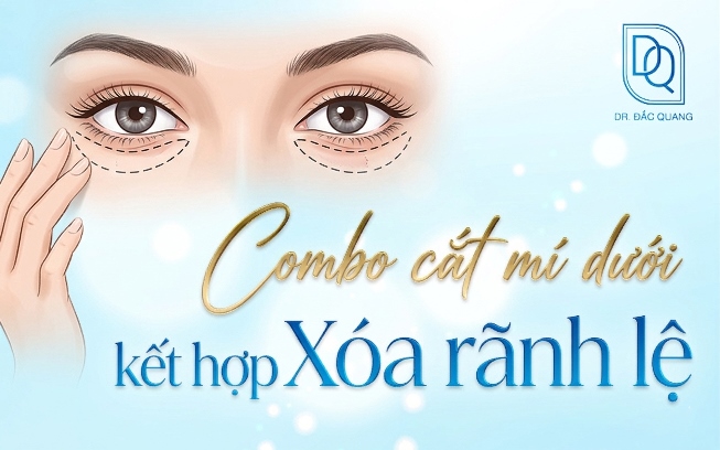 combo cắt mí dưới