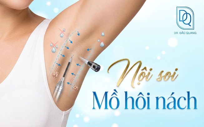 Dịch vụ nội soi