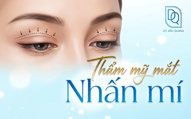 thẩm mỹ mắt nhấn mí