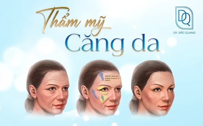 Thẩm mỹ căng da