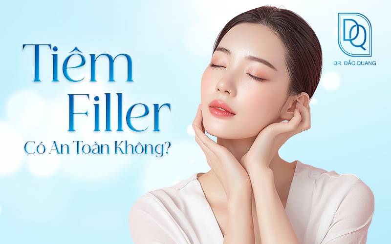 tiêm filler